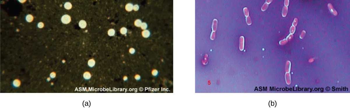 Two micrographs: (a) round, clear, unstained circular cells surrounded by a dark background. (b) Pink-red rod-shaped cells, each surrounded by a pale bluish halo, against a dark purple background.