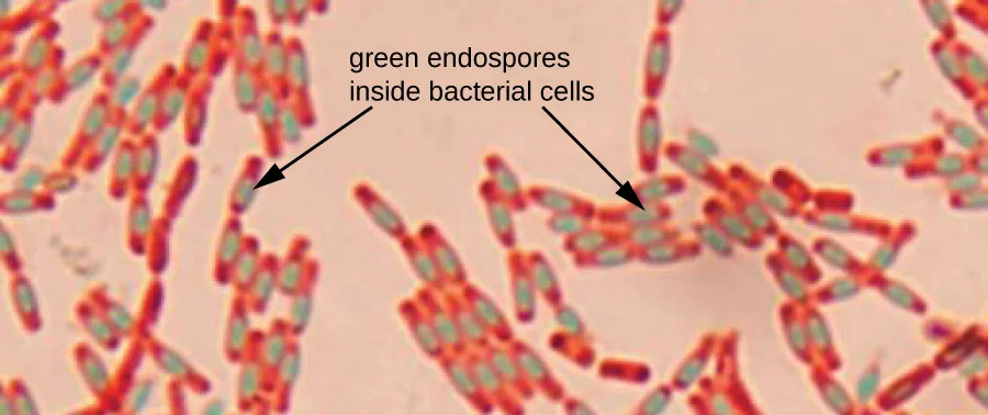A micrograph of pink rod-shaped bacterial cells, each containing a smaller oval region stained green, labeled by two arrows reading green endospores inside bacterial cells.