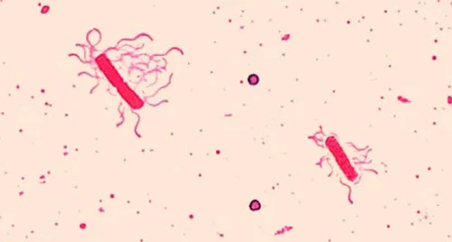 A micrograph of two red, rod-shaped bacterial cells on a pale pink background, each trailing many thin, wavy, thread-like filaments, with small pink specks scattered between them.
