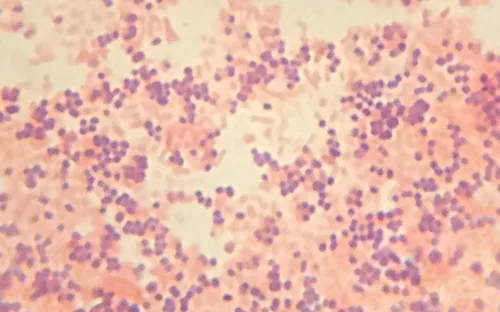 A micrograph showing round purple cells and pink rod-shaped cells together on the same field.