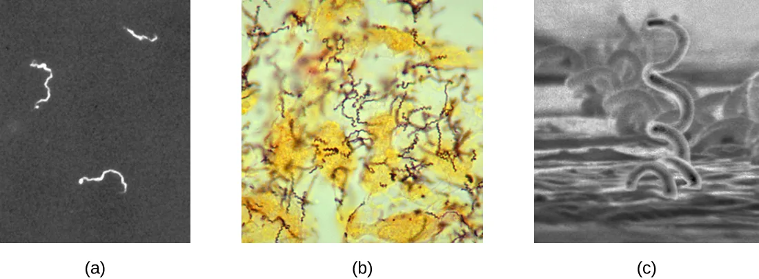 Three micrographs of the same spiral-shaped organism: (a) faint white spirals glowing against a black background. (b) Purple-stained spirals scattered among yellow-brown tissue material. (c) Gray three-dimensional coiled spirals resembling a corkscrew.