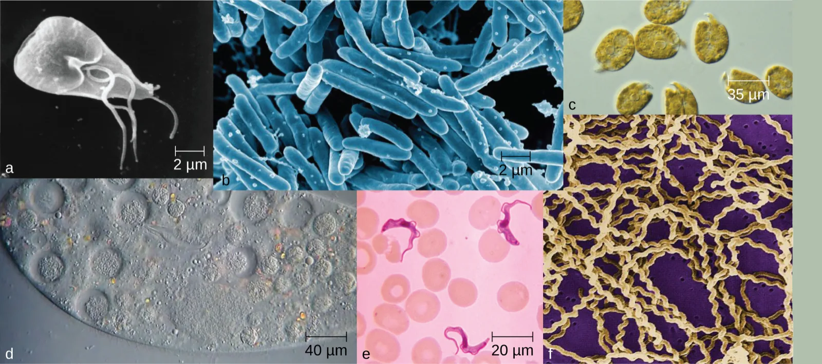 Six micrographs of microbes at different scales. (a) A single pear-shaped cell with several long whip-like flagella trailing from it, 2 µm scale bar. (b) A dense tangle of blue-tinted rod-shaped cells, 2 µm scale bar. (c) Rounded golden-brown cells scattered on a pale background, 35 µm scale bar. (d) The edge of a large oval cell packed with smaller round bodies, 40 µm scale bar. (e) Two curved purple ribbon-shaped cells among round pink blood cells, 20 µm scale bar. (f) Long tan spiral cells crossing one another over a purple background.