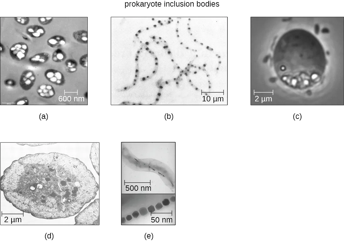 Five labeled micrographs of prokaryotic inclusions. (a) Gray spheres, each holding two to eight smaller white spheres. (b) Thin, thread-like chains scattered with dark spots. (c) A single gray sphere with a cluster of smaller white spheres near its base. (d) A larger sphere containing many smaller internal spheres. (e) A long thread-like filament studded with a chain of small dark spheres, with a magnified inset of the chain.