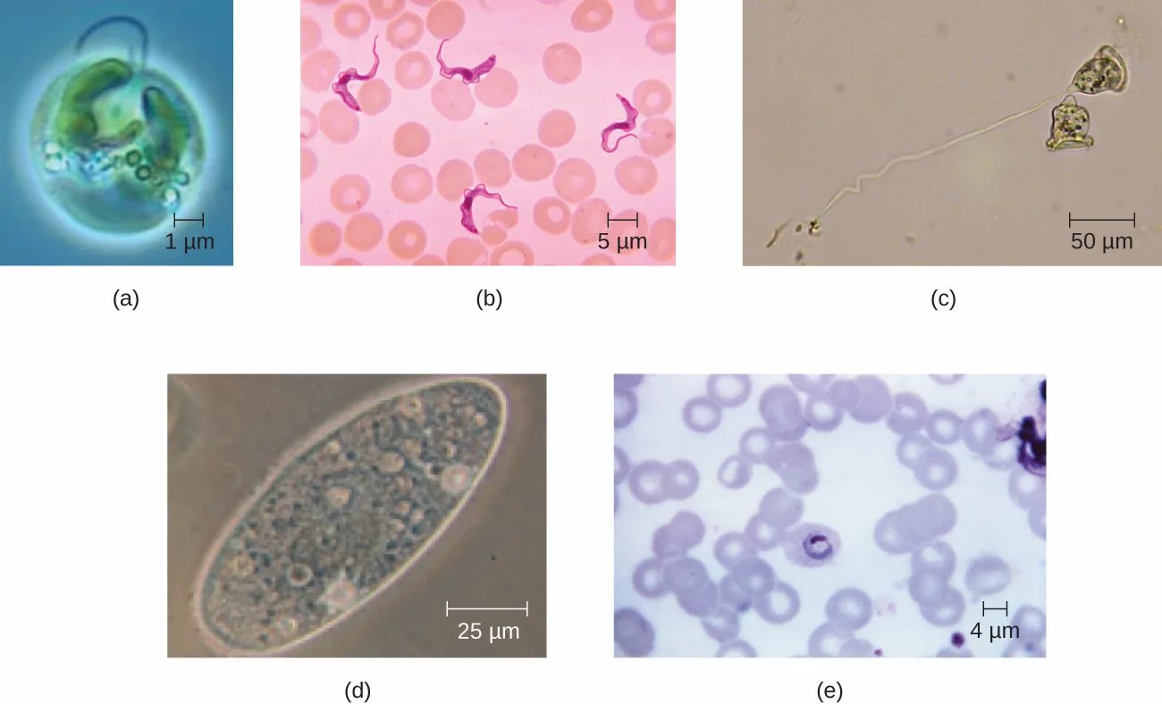 Five micrographs of differently shaped eukaryotic cells: (a) a small spheroid green-and-blue alga; (b) several wavy, ribbon-shaped purple-stained cells among red blood cells; (c) a bell-shaped organism with a long trailing tail; (d) a large oval ciliate; (e) a small ring-shaped parasite inside a red blood cell.