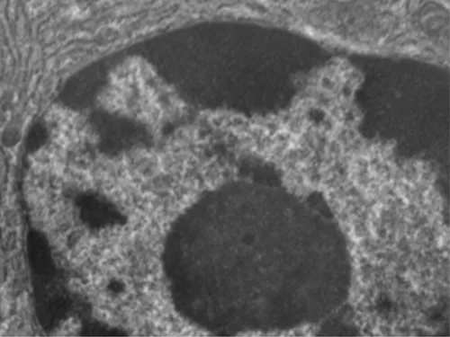 A transmission electron micrograph of part of an oval cell. A darker, rounded structure sits within a larger, paler, textured region near the center of the image.