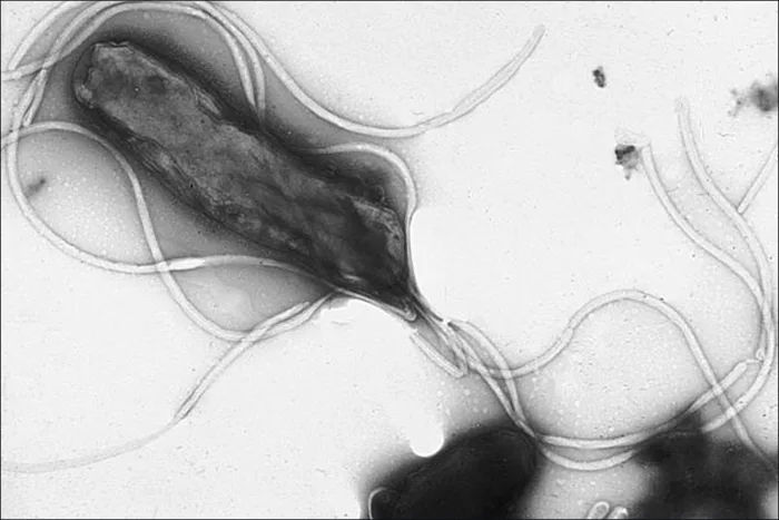 A grayscale electron micrograph of a single curved, rod-shaped Helicobacter pylori cell with a tuft of several long, thin flagella extending from one pole; other flagella loop across the field around the cell.