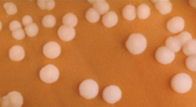 A close photograph of many round, creamy white Neisseria meningitidis colonies scattered across a brown chocolate agar plate.
