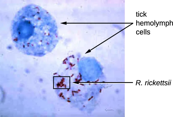 A stained micrograph of two blue tick hemolymph cells. Small red rod-shaped R. rickettsii cells occur inside both cells; arrows identify the tick cells and a boxed cluster identifies R. rickettsii.