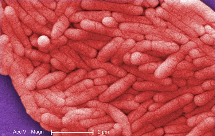 A colorized scanning electron micrograph densely filled with pink rod-shaped Salmonella typhi cells. A 2 µm scale bar appears at the bottom.