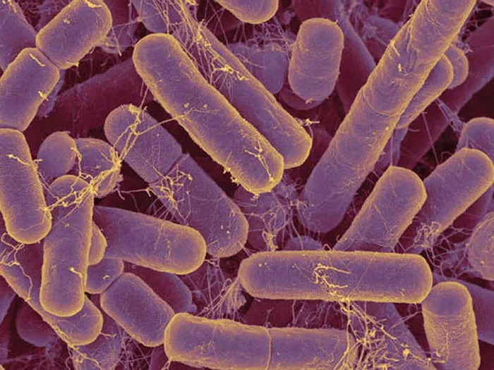 A colorized scanning electron micrograph of many closely packed rod-shaped Bacteroides cells, purple with gold-edged surfaces and fine tangled strands between some cells.