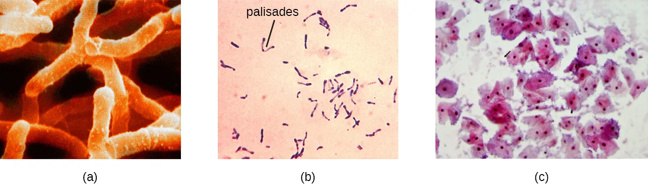 Three panels. (a) A false-color scanning electron micrograph of thick, branching orange rod-shaped Actinomyces cells. (b) A stained light micrograph of short violet rods, several arranged in V-shaped pairs, with an arrow labeling the palisades. (c) A Pap smear with large pink epithelial cells and smaller dark-staining coccobacilli, one indicated by an arrow.