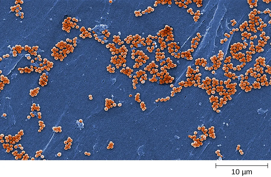 A false-color scanning electron micrograph showing many orange spherical bacterial cells grouped in irregular grape-like clusters across a textured blue surface; a 10 µm scale bar appears at lower right.