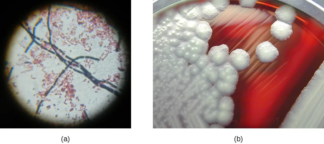 Two panels. (a) A Gram-stained micrograph shows violet rod-shaped Bacillus cereus cells in chains amid smaller pink Escherichia coli cells. (b) A photograph of a red sheep-blood-agar plate shows large irregular white B. cereus colonies along streak lines.