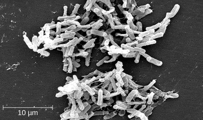 A grayscale scanning electron micrograph of numerous short, pale rod-shaped Clostridioides difficile cells in irregular clusters against a dark background. A 10 µm scale bar appears at lower left.