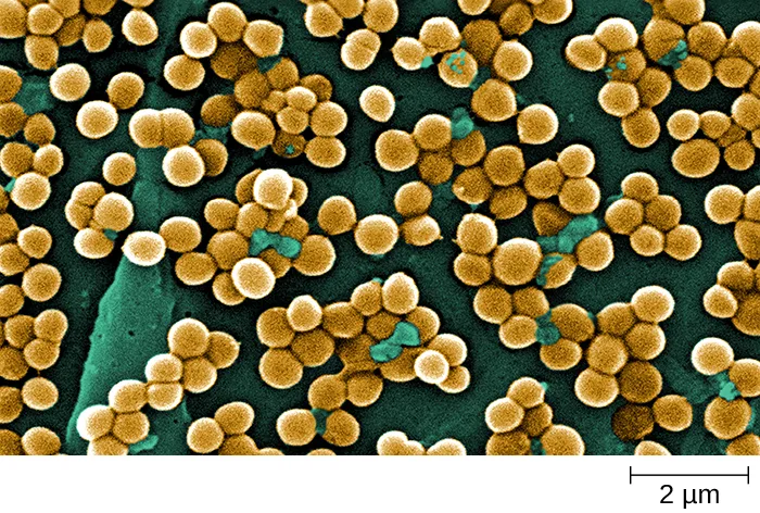 A false-color scanning electron micrograph of many round golden Staphylococcus aureus cells clustered densely like bunches of grapes on a dark green background; a 2 µm scale bar appears at lower right.