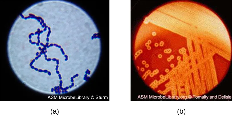 Two panels. (a) A Gram-stained light micrograph shows dark violet spherical Streptococcus pyogenes cells linked in long chains against a pale blue field. (b) A blood-agar plate shows small pale colonies and broad clear halos around them, indicating red-blood-cell lysis.