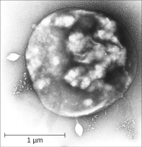 A transmission electron micrograph of a roughly spherical Sulfolobus cell with many irregular pale granules inside and a 1 µm scale bar.
