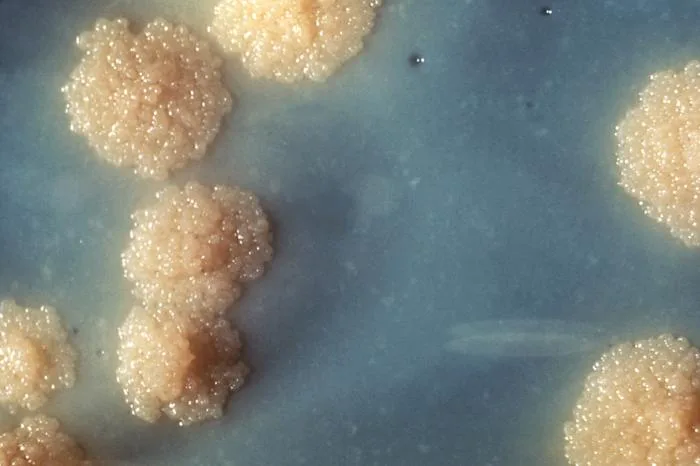 A photograph of irregular, raised, granular pale beige Mycobacterium tuberculosis colonies growing on blue-green Löwenstein-Jensen agar.