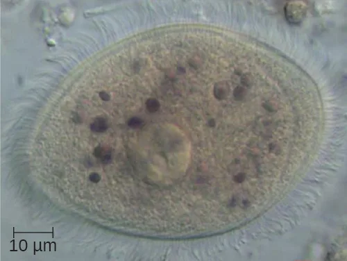 A light micrograph of a single oval Balantidium coli trophozoite covered in short, hair-like cilia, with a 10 µm scale bar.