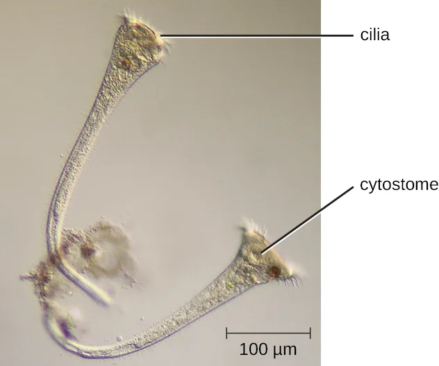 A micrograph of a bent, thread-like ciliate with a flared, cilia-fringed cup at one end labeled cilia and a second flared end labeled cytostome, joined by a narrow stalk, with a 100 µm scale bar.