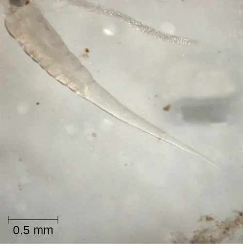 A micrograph of a translucent, tapered, spindle-shaped worm on a pale background, beside a scale bar reading 0.5 mm.