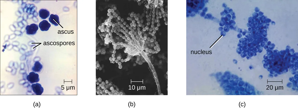 Three micrographs of ascomycete spore structures. (a) A brightfield micrograph labeled ascus and ascospores, showing clusters of small oval cells among rounder, darker-staining cells, with a 5 µm scale bar. (b) A grayscale electron micrograph of a stalked structure bearing many small round spores, with a 10 µm scale bar. (c) A brightfield micrograph labeled nucleus, showing clusters of round budding cells, with a 20 µm scale bar.