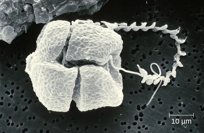 A scanning electron micrograph of a boxy, ridged dinoflagellate cell with two long projections extending from one side — a thicker, tightly coiled beaded strand and a thinner smooth strand — beside a 10 µm scale bar.