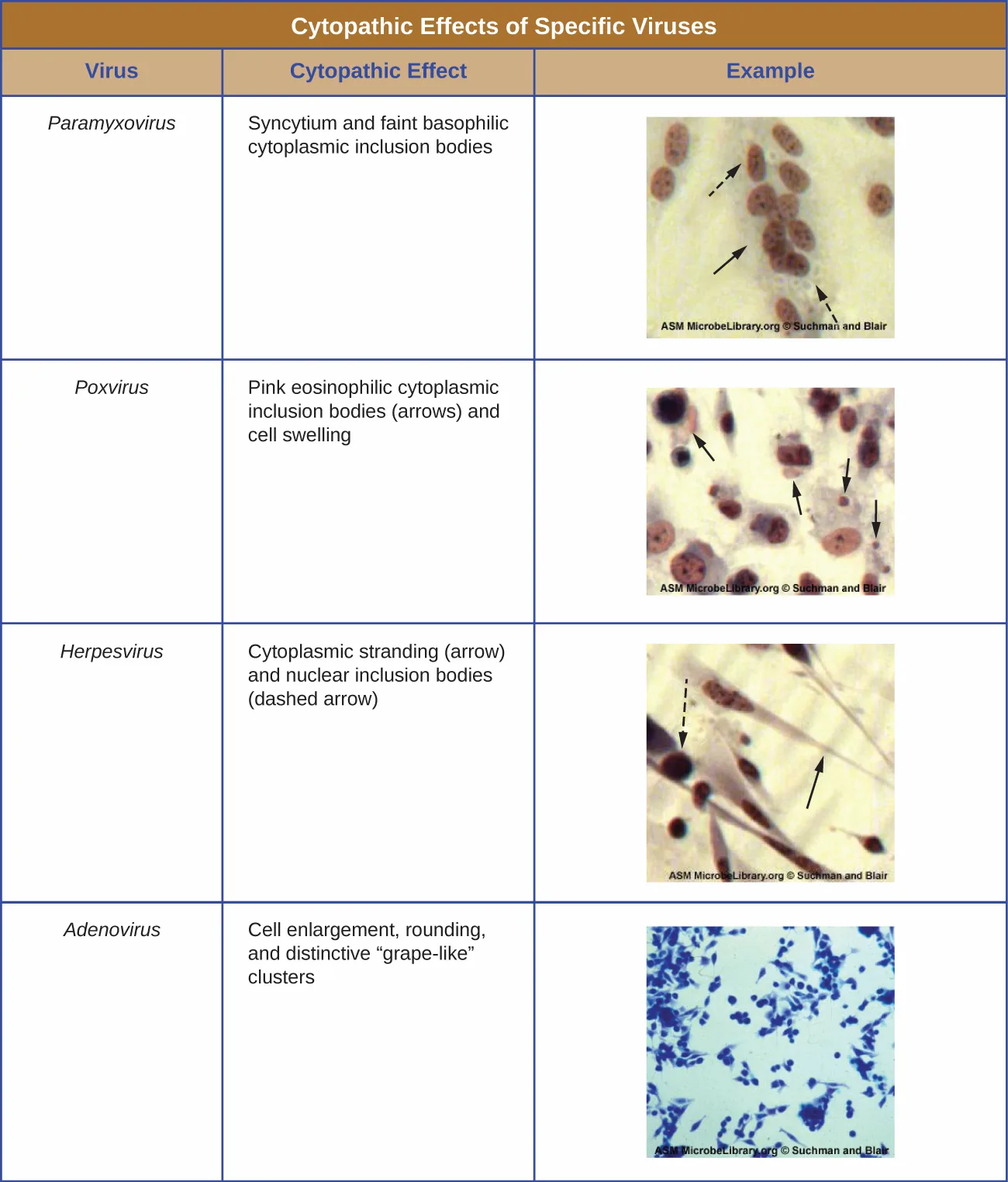 Four sample micrographs, one per row of the table above: purple-stained round cells with faint clustered specks for paramyxovirus; scattered purple-stained round cells with darker pink round inclusions marked by arrows for poxvirus; elongated, thread-like purple-stained cells with dark round inclusions marked by arrows for herpesvirus; and a field of blue-stained, branching, grape-cluster-shaped cells for adenovirus.