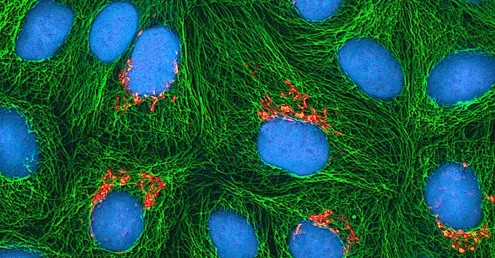 A fluorescence micrograph of several adjoining cells, each containing a large blue-stained round nucleus; near several nuclei is a small cluster of orange ovals, and a dense green fibrous network fills the rest of each cell.