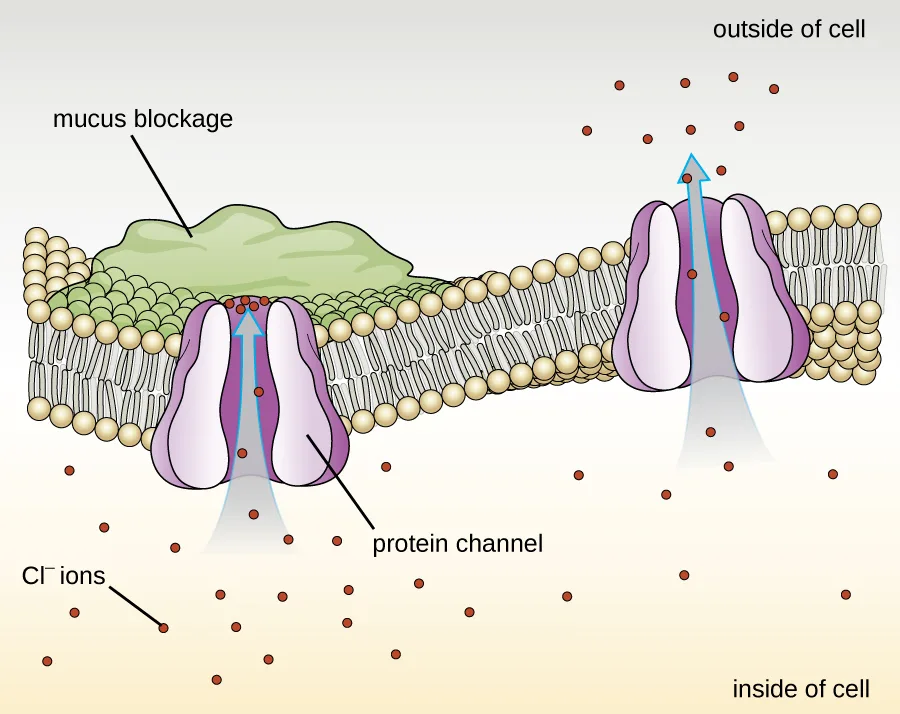 A phospholipid bilayer with two identical channel proteins spanning it. Chloride ions pass freely up through the channel on the right and out of the cell. A patch of mucus sits atop the channel on the left, and the chloride ions beneath it cannot pass through to the outside.