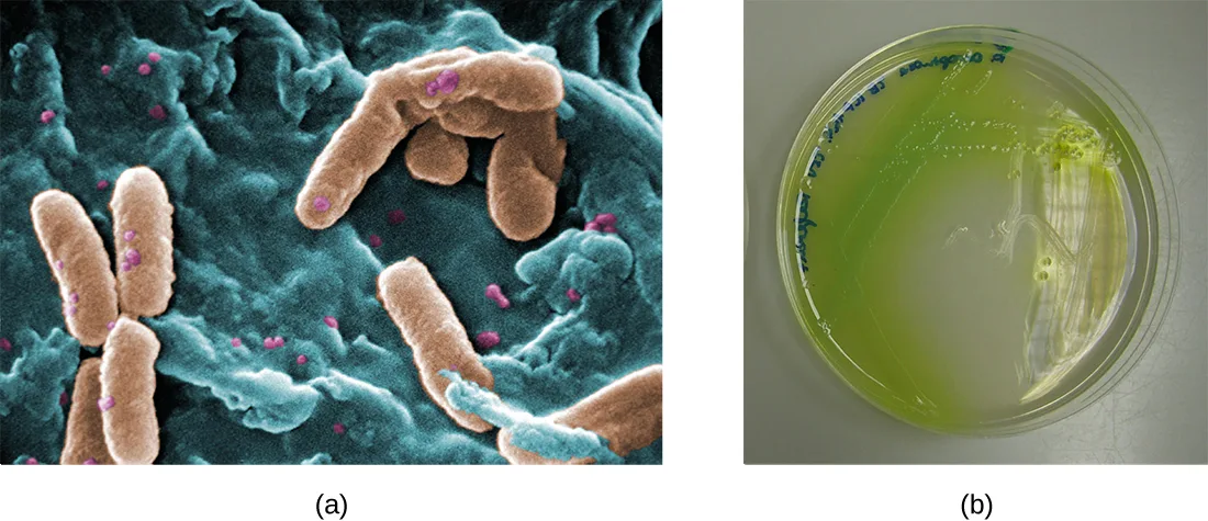 (a) A colorized scanning electron micrograph of several tan, rod-shaped bacterial cells scattered among smaller pink spherical particles on a teal background. (b) A circular agar plate whose left side is covered in green-pigmented bacterial growth, with the green pigment visibly diffusing into the clear agar beyond the edge of the growth.