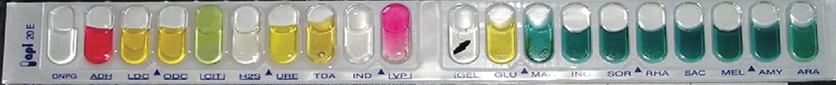 A photograph of an API 20NE test strip: a row of small wells labeled ONPG, ADH, LDC, ODC, CIT, H2S, URE, TDA, IND, and VP, followed by a second row labeled GEL, GLU, MAN, INO, SOR, RHA, SAC, MEL, AMY, and ARA. Most wells hold a pale yellow or teal-green liquid; ADH is pink-red, VP is bright pink, and ONPG, H2S, IND, and GEL are clear or white, with GEL also showing a dark streak across it.