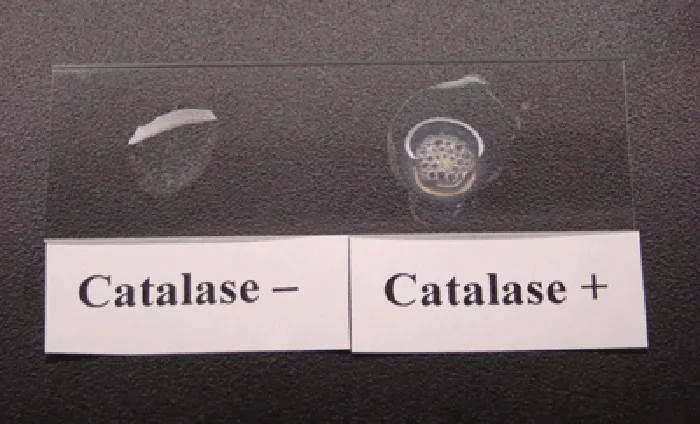 A photograph of a glass slide on a dark background holding two drops of liquid, each above a printed label. The left drop, labeled “Catalase –,” is a plain clear droplet with no bubbles. The right drop, labeled “Catalase +,” is cloudy with many small bubbles throughout.