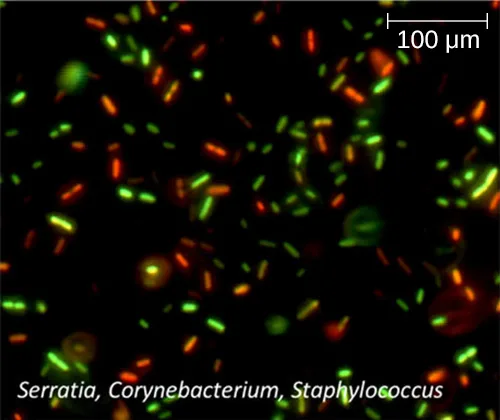 A fluorescence micrograph on a black background showing many glowing green rod- and coccus-shaped cells and fewer glowing red or orange cells of similar shapes, with a 100 µm scale bar and the caption text Serratia, Corynebacterium, Staphylococcus printed in the corner.