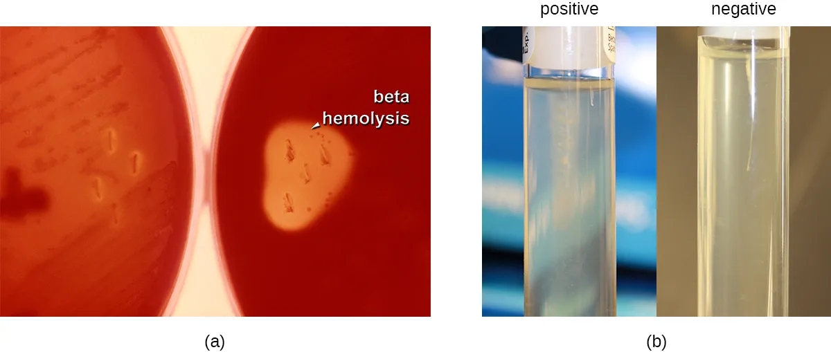 (a) A photograph of two red blood agar plates, each streaked with bacterial colonies. The colonies on the left plate sit in agar that is uniformly dark red, with no lightened zone around them. On the right plate, labeled “beta hemolysis,” the colonies sit within a pale, cleared halo where the surrounding blood has been broken down. (b) A photograph of two clear broth tubes side by side. The tube labeled “positive” is cloudy, with growth spreading outward from the central stab line through the medium. The tube labeled “negative” stays clear, with growth confined to the stab line itself.
