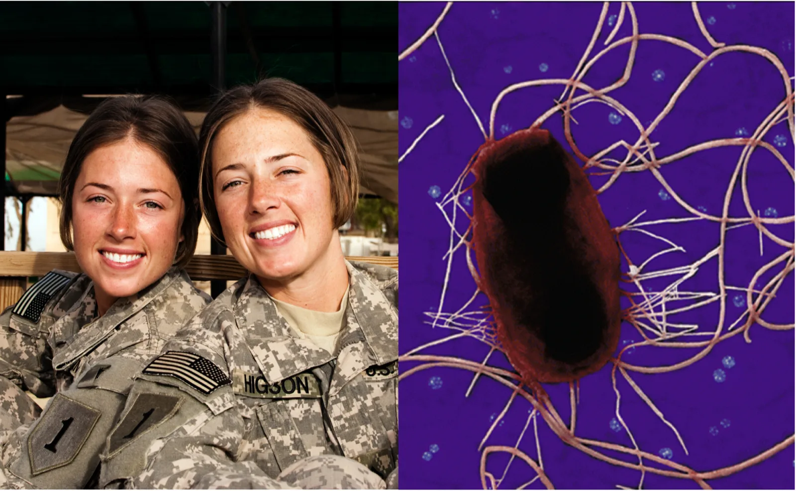 Two photographs. Left, two smiling young women in camouflage uniforms with matching short dark hair, seated side by side; their faces are nearly identical. Right, a false-colour micrograph of a single dark-red oval cell on a purple background, with many long pale filaments radiating from its surface and small blue dots scattered around it.