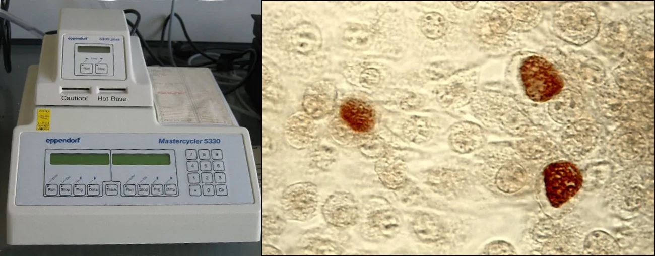 Two photographs. Left, a benchtop thermal cycler: a boxy machine with a heated sample block under a raised lid and a small display and keypad on its front. Right, a light micrograph of many pale, rounded, unstained cells, three of which contain a large body stained orange-brown.