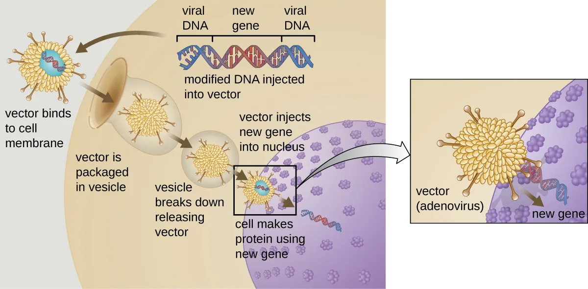 A diagram of gene therapy using an adenovirus vector. Above, a DNA strand labeled viral DNA, new gene, and viral DNA is captioned 'modified DNA injected into vector.' Below, five labeled steps trace the vector, a spiky viral particle, from outside a cell to its nucleus: the vector binds to the cell membrane; it is packaged in a vesicle; the vesicle breaks down, releasing the vector; the vector injects the new gene into the nucleus; and the cell makes protein using the new gene. An inset at right zooms in on the vector, labeled 'vector (adenovirus),' delivering the new gene into the nucleus.