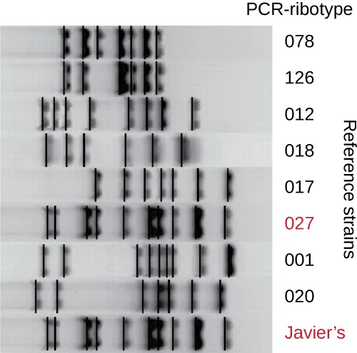 A gel with eight lanes of PCR-ribotype reference strains, labeled top to bottom 078, 126, 012, 018, 017, 027, 001, and 020, each showing a distinct pattern of vertical bands, plus a ninth lane at the bottom labeled Javier's whose band pattern matches the 027 reference lane above it.