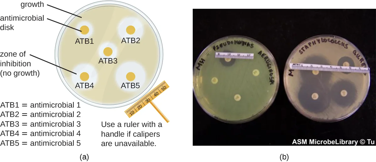(a) A drawing of a bacterial lawn on an agar plate labeled 'growth,' with five antimicrobial disks labeled ATB1 through ATB5; a clear zone of inhibition of varying width surrounds each disk, and a ruler is shown measuring across one zone. (b) A photograph of two actual agar plates, each hand-labeled with the bacterial species streaked on it and ringed with a paper measuring strip, showing several antimicrobial disks with clear zones of inhibition of different sizes around them.