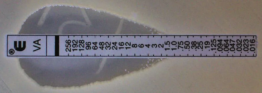 A photograph of a narrow plastic strip printed with descending concentration values from 256 down to 0.016 µg/mL and labeled E and VA at one end, lying across a lawn of bacteria on an agar plate. A pale, teardrop-shaped zone of inhibited growth surrounds the strip, wide at the high-concentration end and narrowing to a point near the low-concentration end, crossing the strip near the 2 mark.