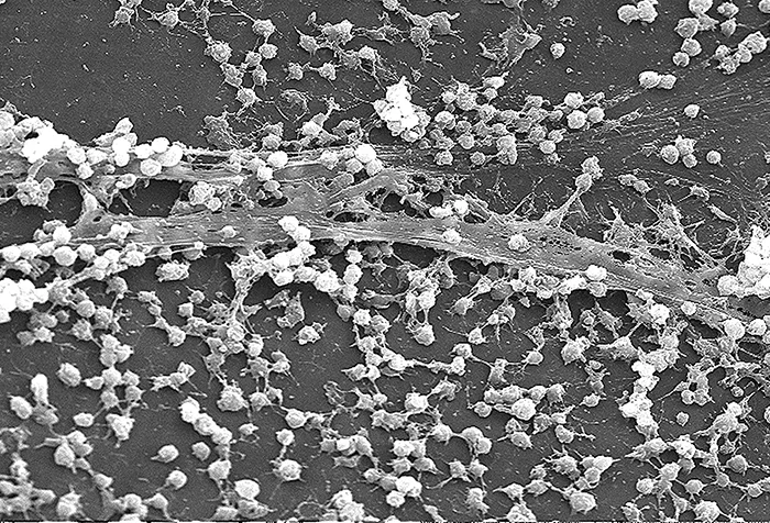 A grayscale scanning electron micrograph of small round cells clustered densely across a surface and attached to it and to each other by long, thin strands.