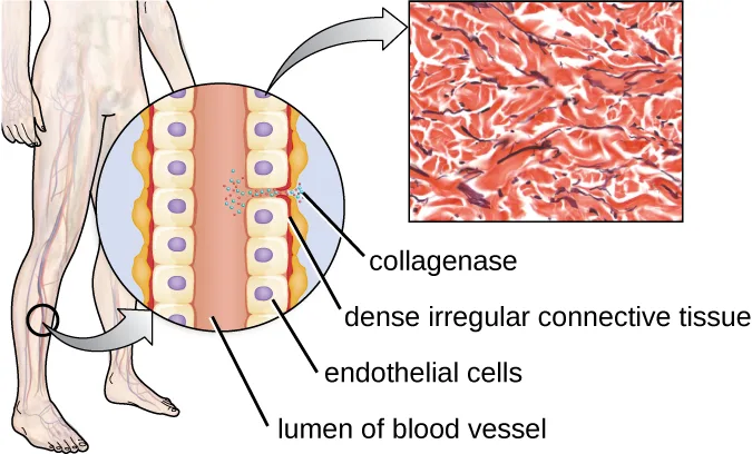 A diagram of a human leg with a circular inset zooming into a cross-section of a blood vessel: a central lumen lined by endothelial cells, surrounded by dense irregular connective tissue, with small collagenase dots breaking gaps between the endothelial cells; an arrow leads to a micrograph of red, fibrous connective tissue.
