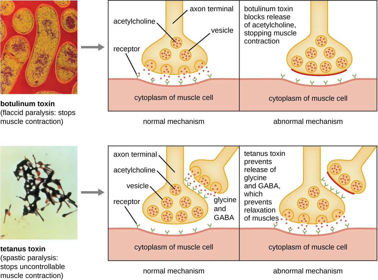 A two-row, three-column diagram comparing botulinum toxin (top row) and tetanus toxin (bottom row). Left column: a micrograph of each bacterium. Middle column: the normal neuromuscular-junction mechanism, an axon terminal releasing vesicles of neurotransmitter onto a muscle-cell membrane's receptors. Right column: the abnormal mechanism once each toxin blocks its target neurotransmitter's release.